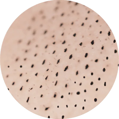 Mikro Dots Haarpigmentierer für Mikro Dots