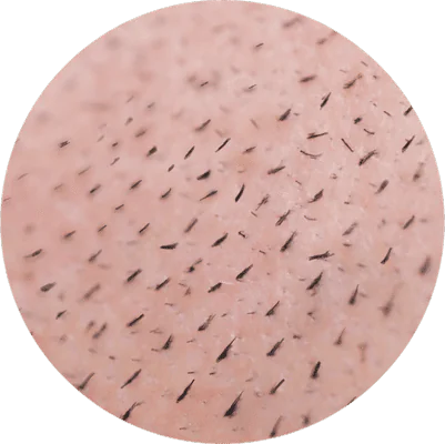 Short Lines Haarpigmentierer für Short Lines
